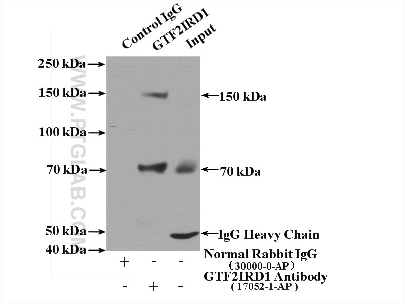 GTF2IRD1 Antibody in Immunoprecipitation (IP)