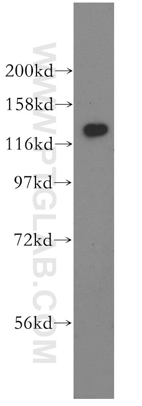 GTF2IRD1 Antibody in Western Blot (WB)