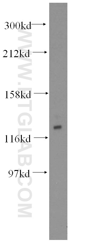 GTF2IRD1 Antibody in Western Blot (WB)