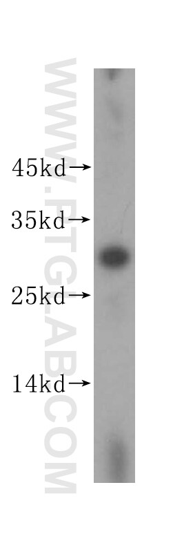BPGM Antibody in Western Blot (WB)