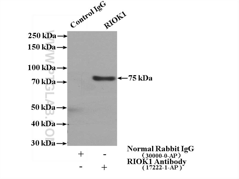 RIOK1 Antibody in Immunoprecipitation (IP)