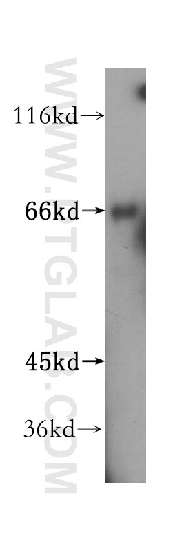 RIOK1 Antibody in Western Blot (WB)