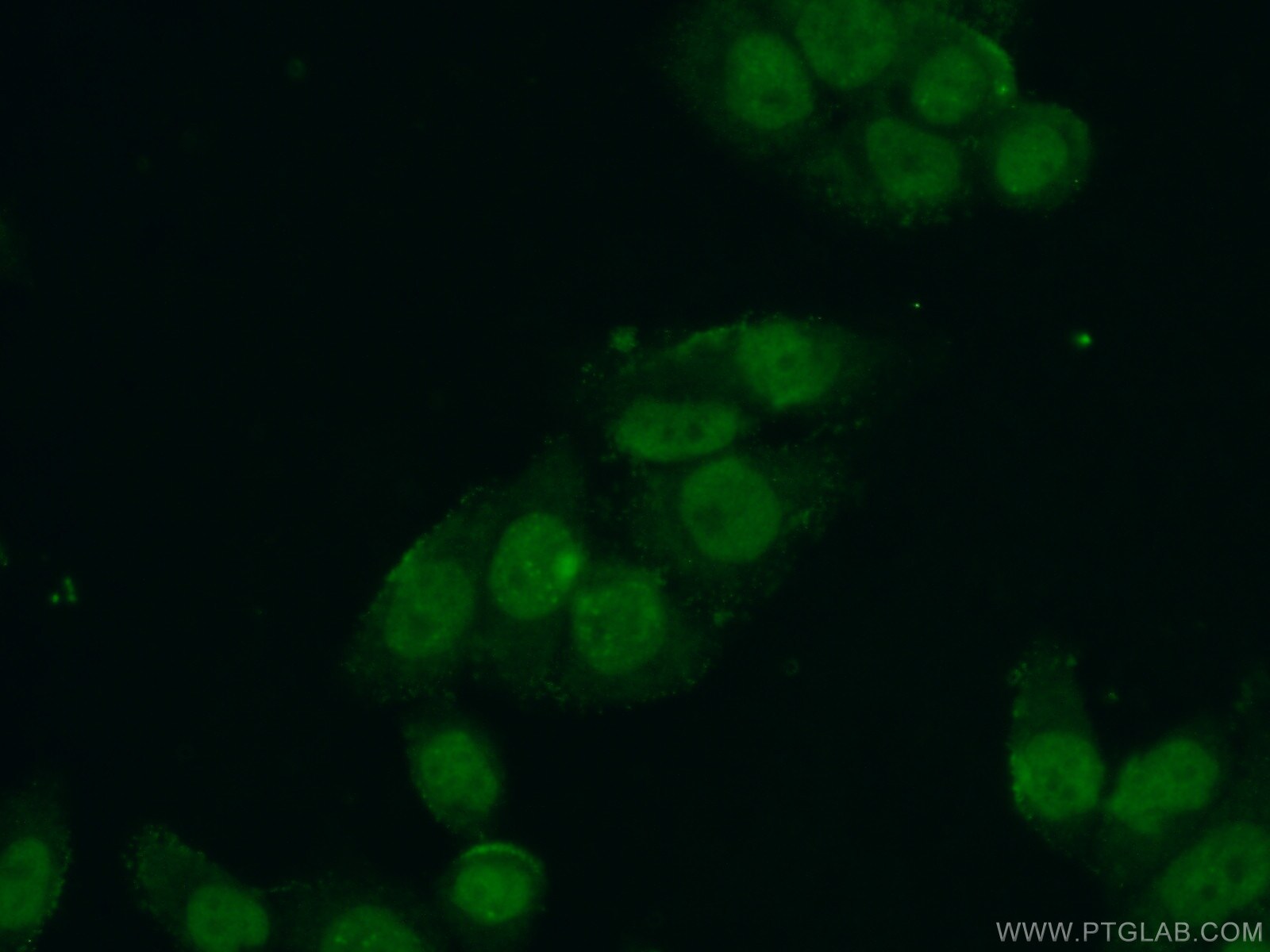 CTDSPL2 Antibody in Immunocytochemistry (ICC/IF)