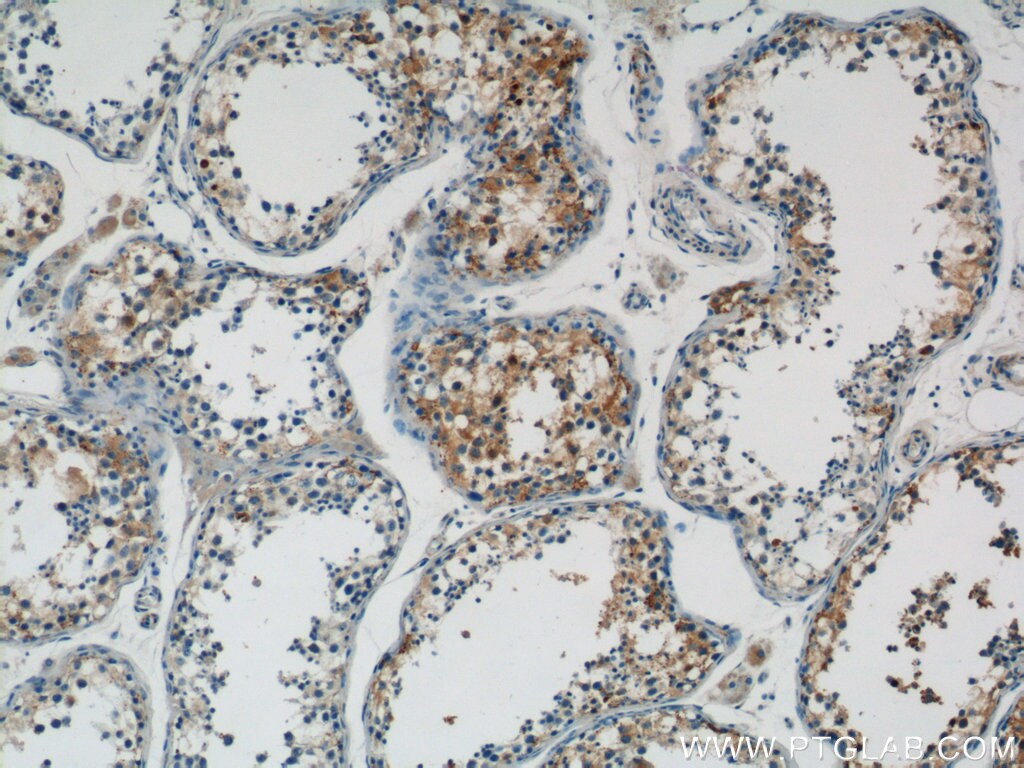 CTDSPL2 Antibody in Immunohistochemistry (Paraffin) (IHC (P))