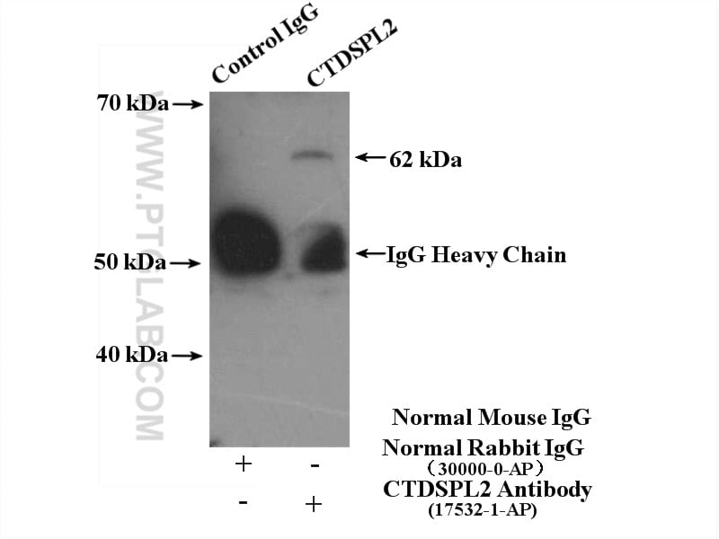 CTDSPL2 Antibody in Immunoprecipitation (IP)