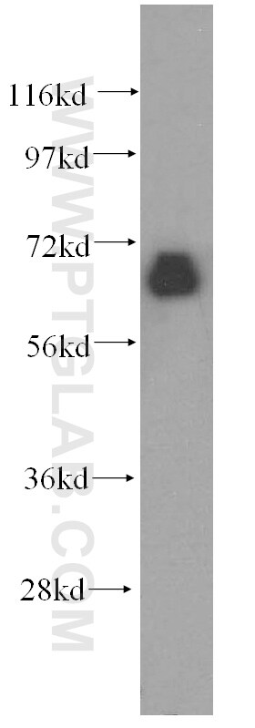 CTDSPL2 Antibody in Western Blot (WB)