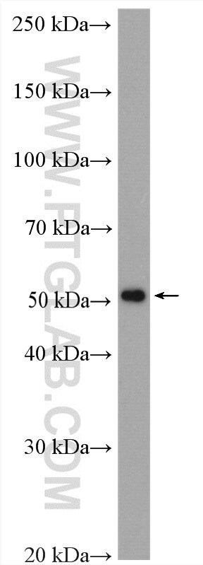 TRMT11 Antibody in Western Blot (WB)