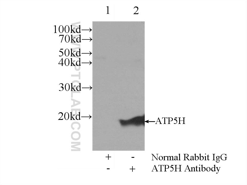 ATP5H Antibody in Immunoprecipitation (IP)