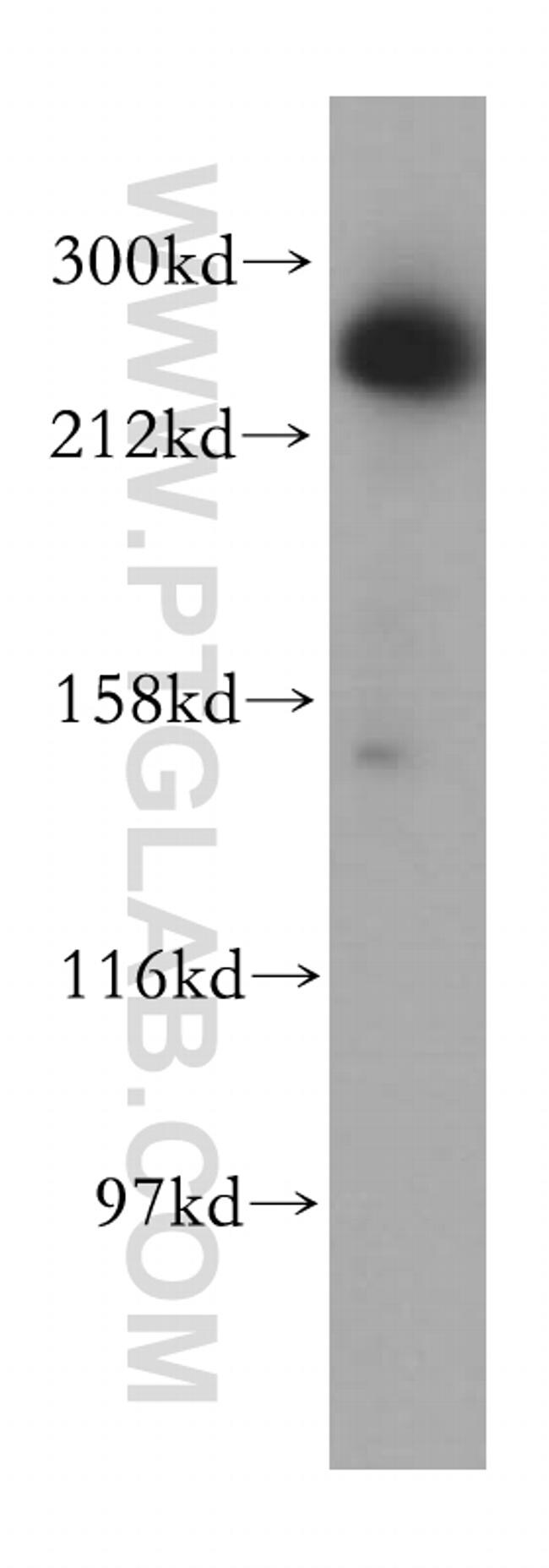 ASCC3 Antibody in Western Blot (WB)