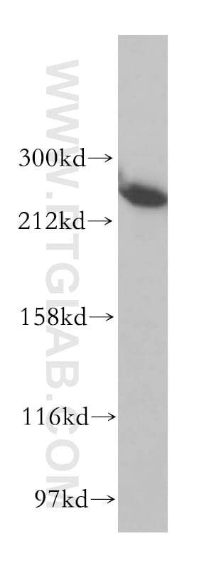 ASCC3 Antibody in Western Blot (WB)