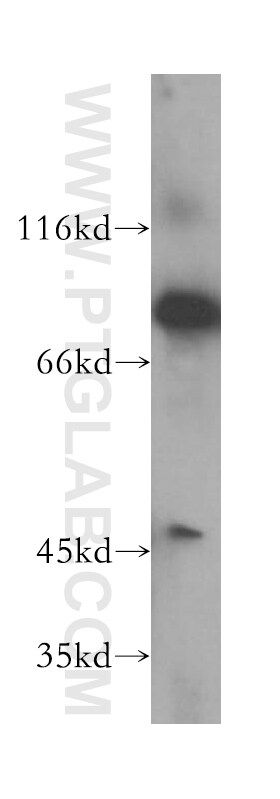 P5CS Antibody in Western Blot (WB)