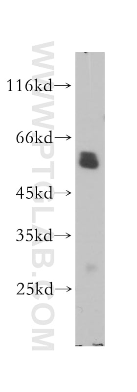 CORO1A Antibody in Western Blot (WB)
