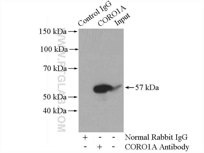 CORO1A Antibody in Immunoprecipitation (IP)