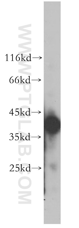 SGCG Antibody in Western Blot (WB)