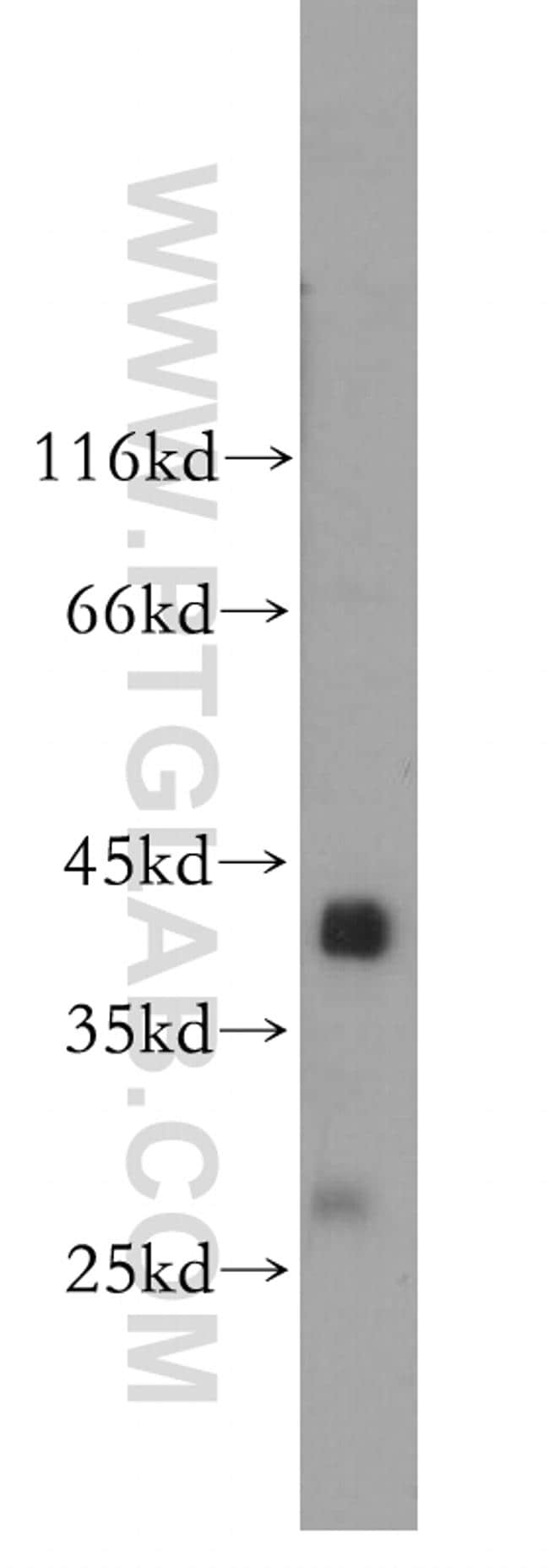 SGCG Antibody in Western Blot (WB)