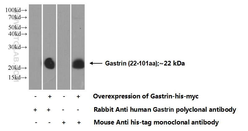Gastrin Antibody in Western Blot (WB)