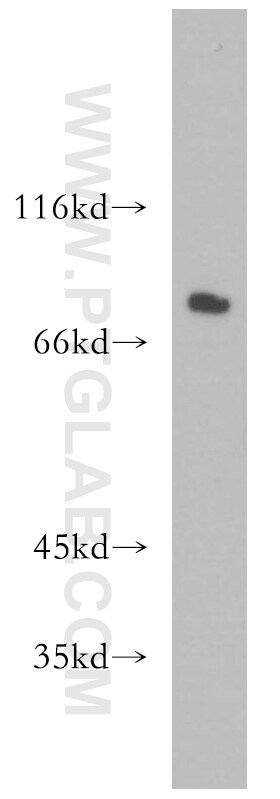 NHE8 Antibody in Western Blot (WB)