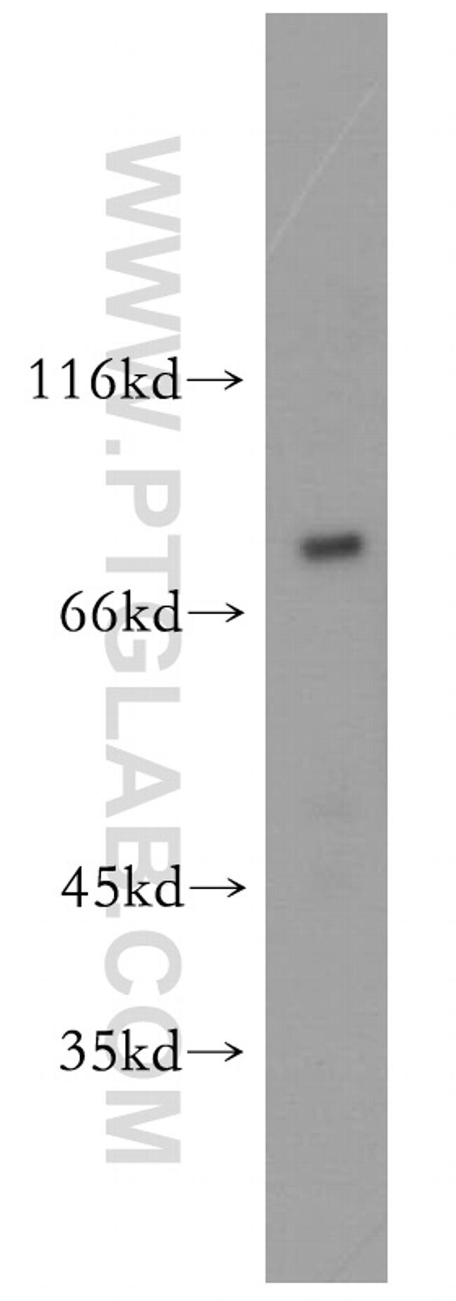 NHE8 Antibody in Western Blot (WB)