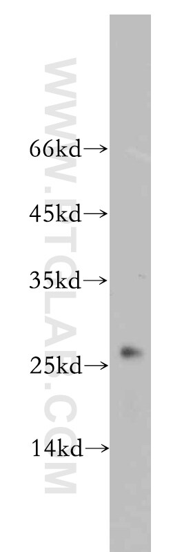 UQCRFS1 Antibody in Western Blot (WB)