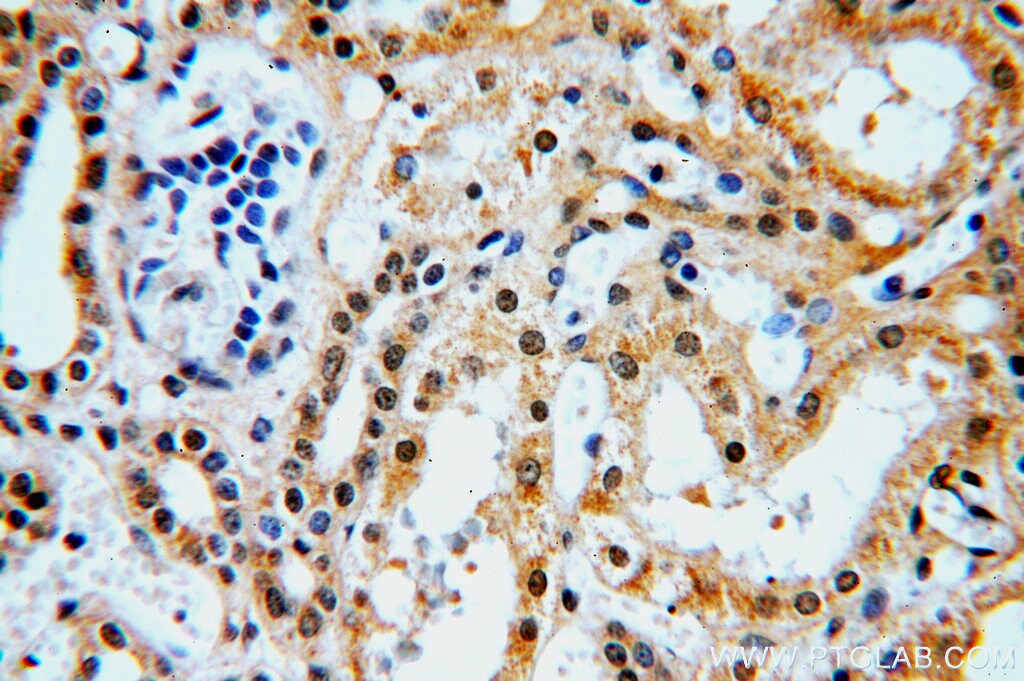 HEY1 Antibody (19929-1-AP)