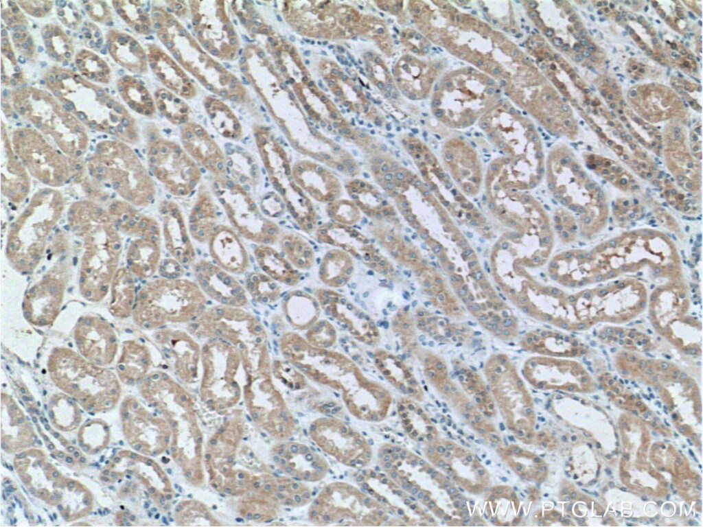 Tuberin Antibody in Immunohistochemistry (Paraffin) (IHC (P))