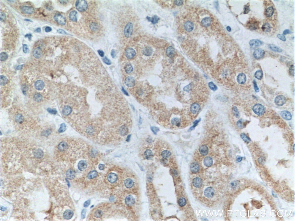 Tuberin Antibody in Immunohistochemistry (Paraffin) (IHC (P))
