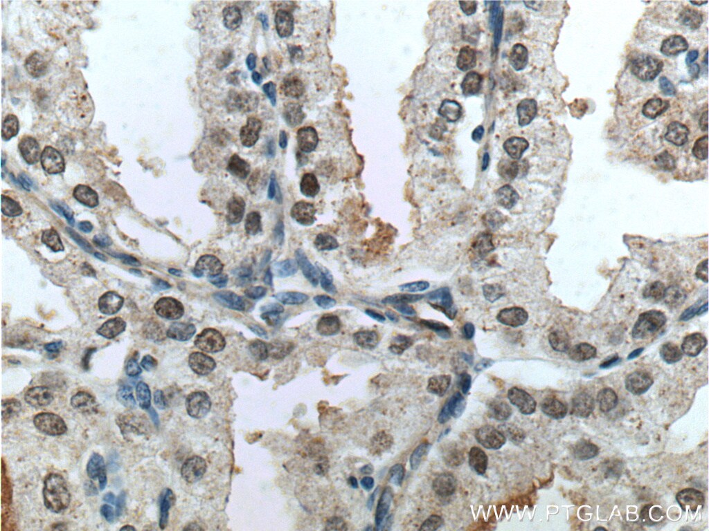 FOXA1 Antibody in Immunohistochemistry (Paraffin) (IHC (P))