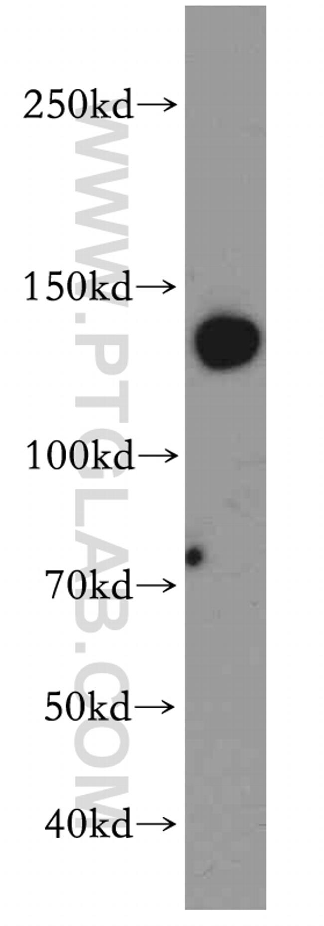 SUPT16H Antibody in Western Blot (WB)
