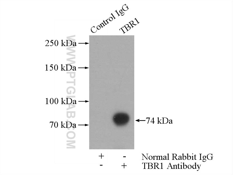 TBR1 Antibody in Immunoprecipitation (IP)