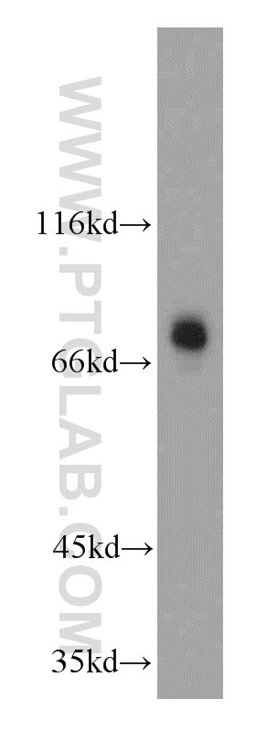 TBR1 Antibody in Western Blot (WB)