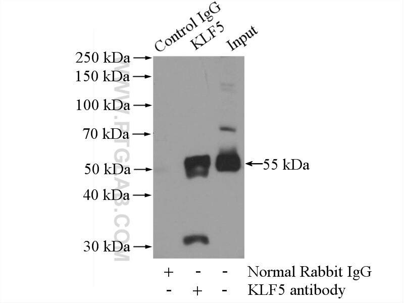 KLF5 Antibody in Immunoprecipitation (IP)