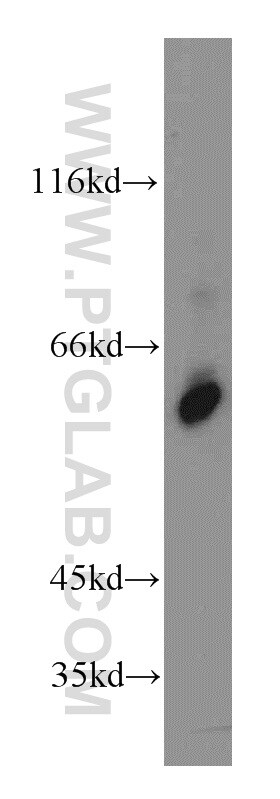 KLF5 Antibody in Western Blot (WB)
