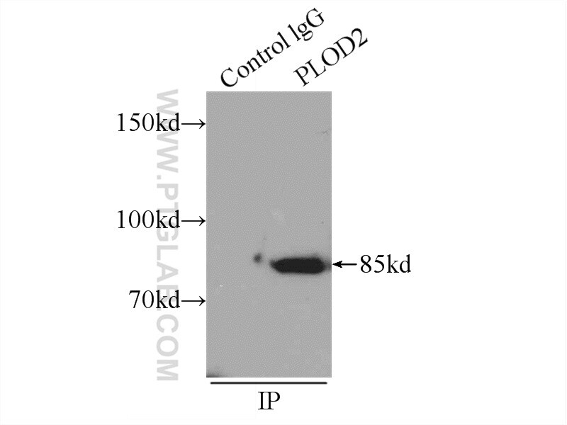 PLOD2 Antibody in Immunoprecipitation (IP)
