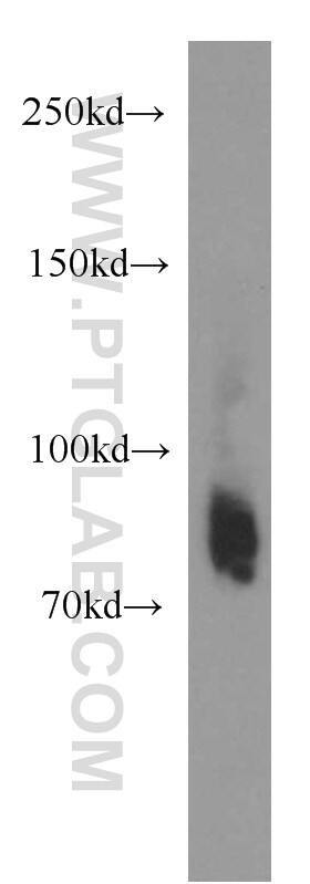 PLOD2 Antibody in Western Blot (WB)