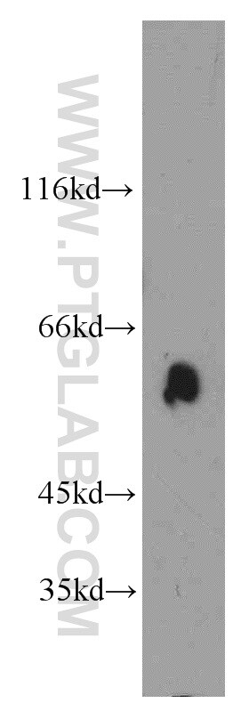 Catalase Antibody in Western Blot (WB)