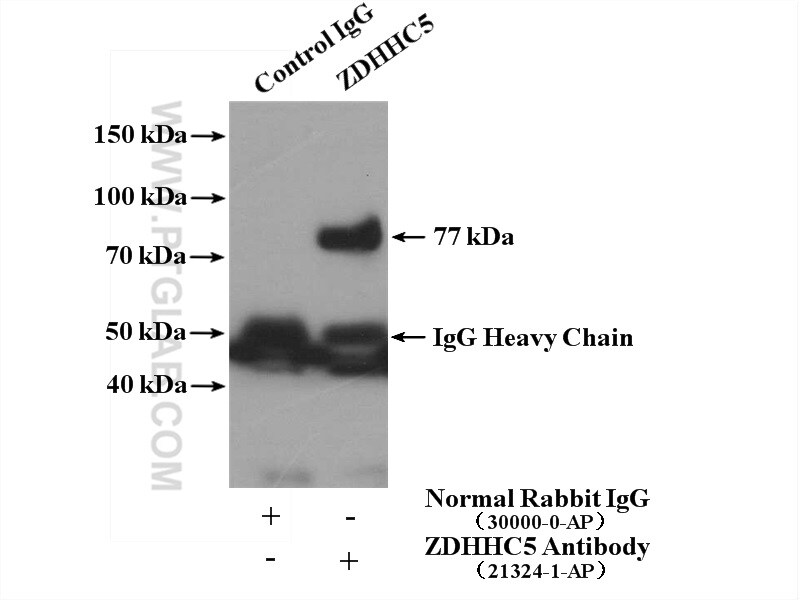ZDHHC5 Antibody in Immunoprecipitation (IP)