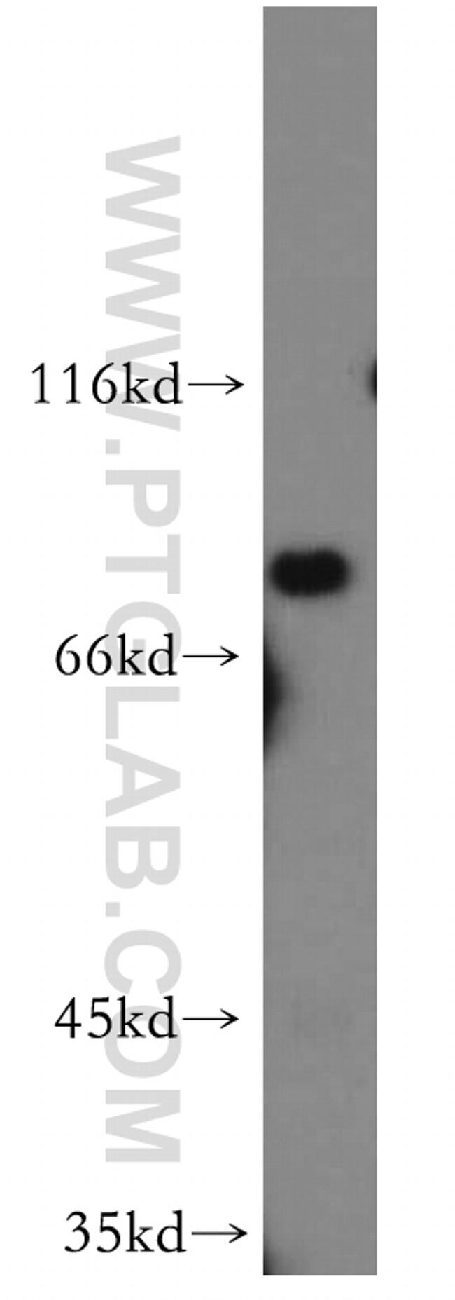 ZDHHC5 Antibody in Western Blot (WB)
