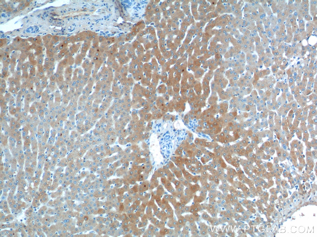 C3/C3b/C3c Antibody (21337-1-AP)