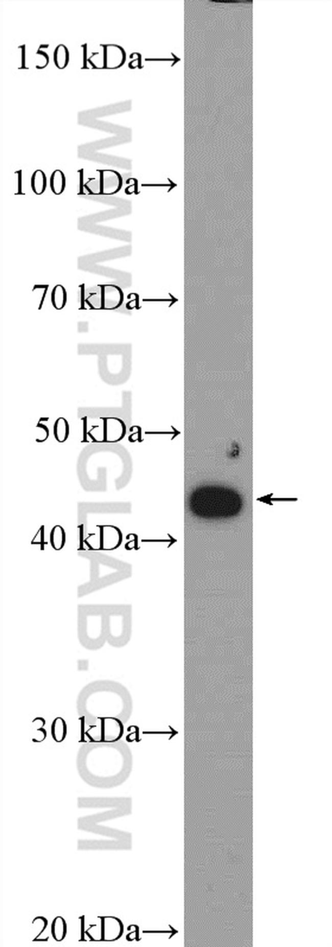 ZDHHC15 Antibody in Western Blot (WB)