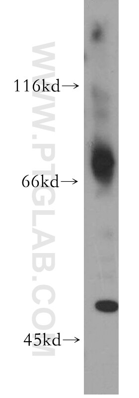 SLC5A3 Antibody in Western Blot (WB)