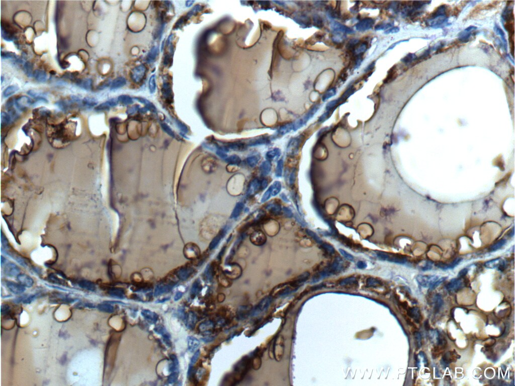 Thyroglobulin antibody 21714 1 ap 