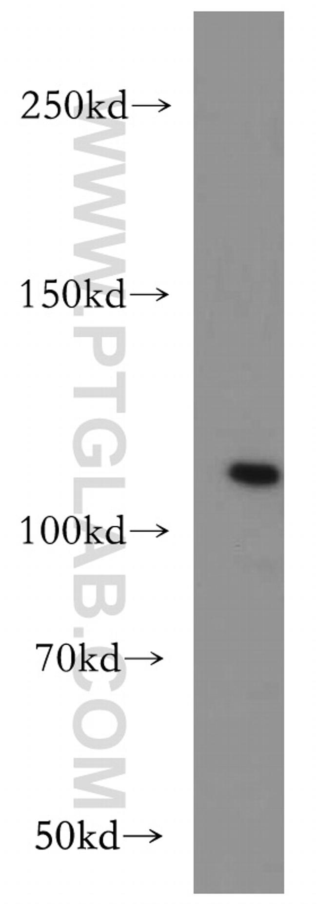 PI3K p110(beta) Antibody in Western Blot (WB)