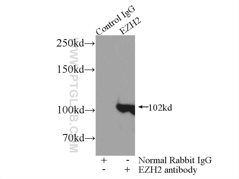 EZH2 Antibody in Immunoprecipitation (IP)