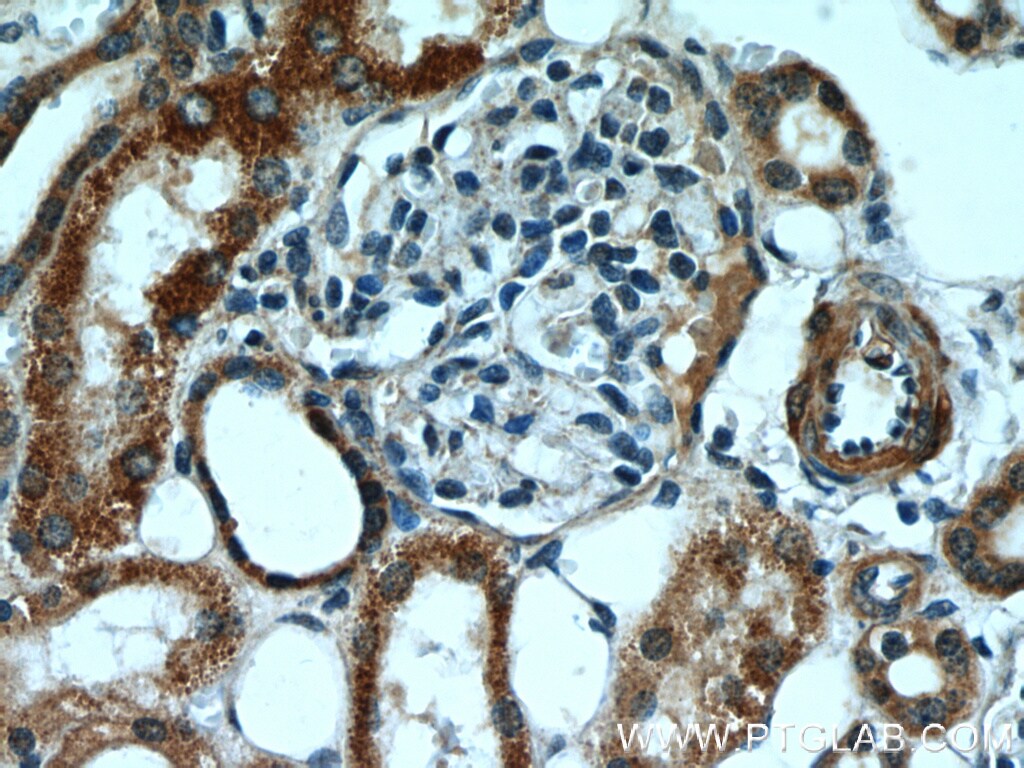 TBC1D1 Antibody in Immunohistochemistry (Paraffin) (IHC (P))