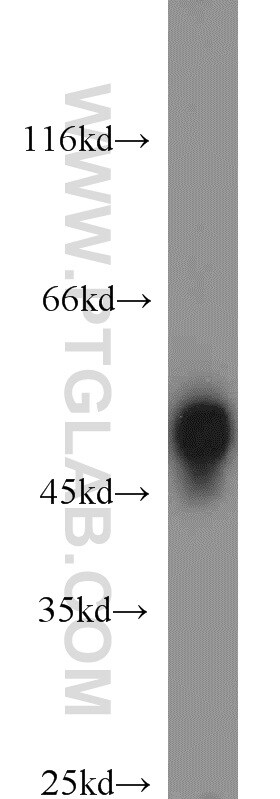 RCC1 Antibody in Western Blot (WB)
