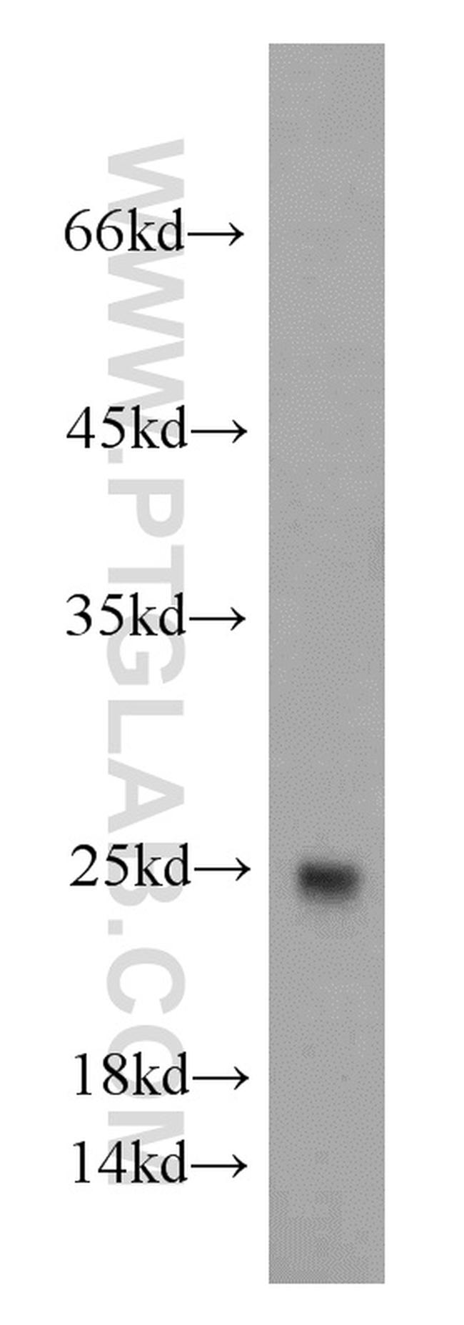 TNNI1 Antibody in Western Blot (WB)