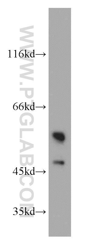 PKLR Antibody in Western Blot (WB)