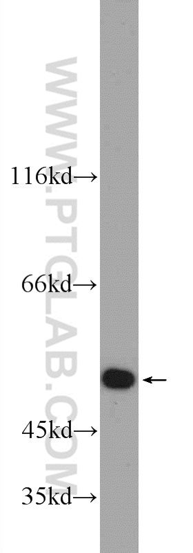 EYA1 Antibody in Western Blot (WB)