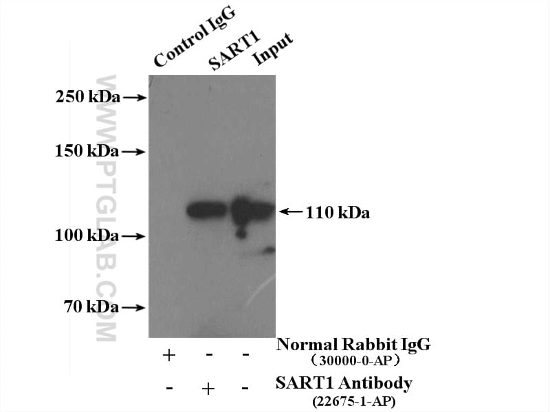 SART1 Antibody in Immunoprecipitation (IP)