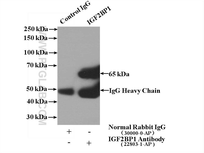 IGF2BP1 Antibody in Immunoprecipitation (IP)